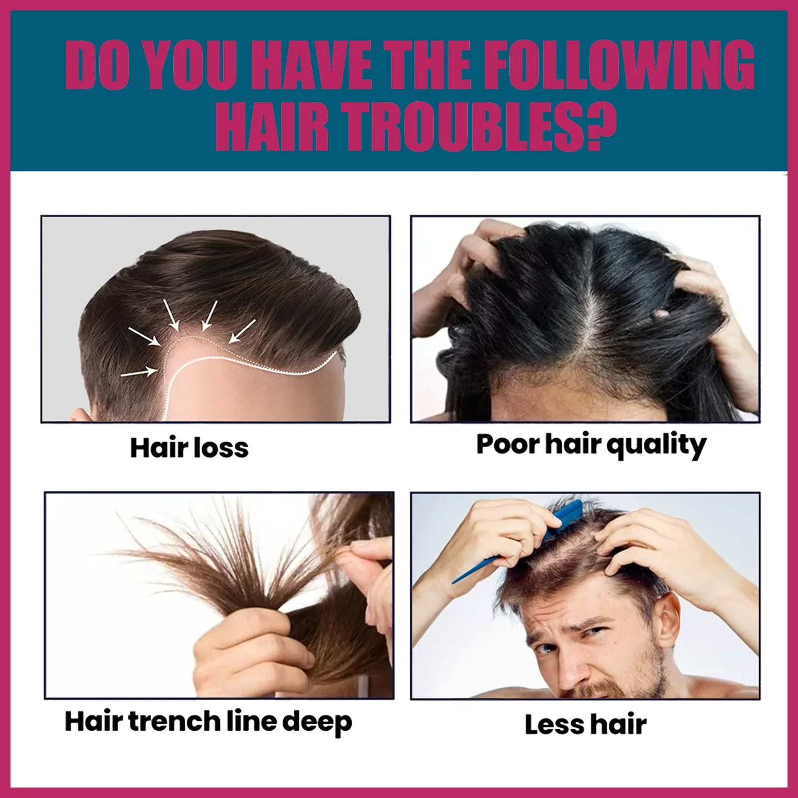 Biotin-Kollagen Haarpflege-Öl, – Hair Care Frizzy Hair Bewertung und Preis