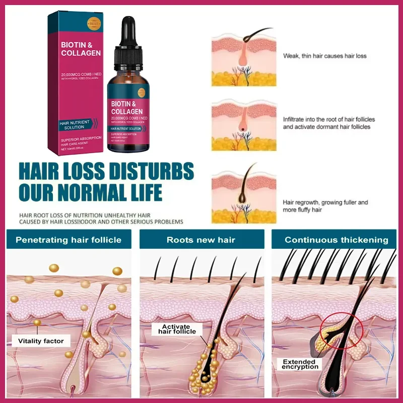 Biotin-Kollagen Haarpflege-Öl, – Hair Care Frizzy Hair Bewertung und Preis