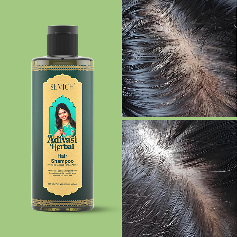 SEVICH Kräuter-Haarwachstumsöl – Hair Care India Bewertung und Preis