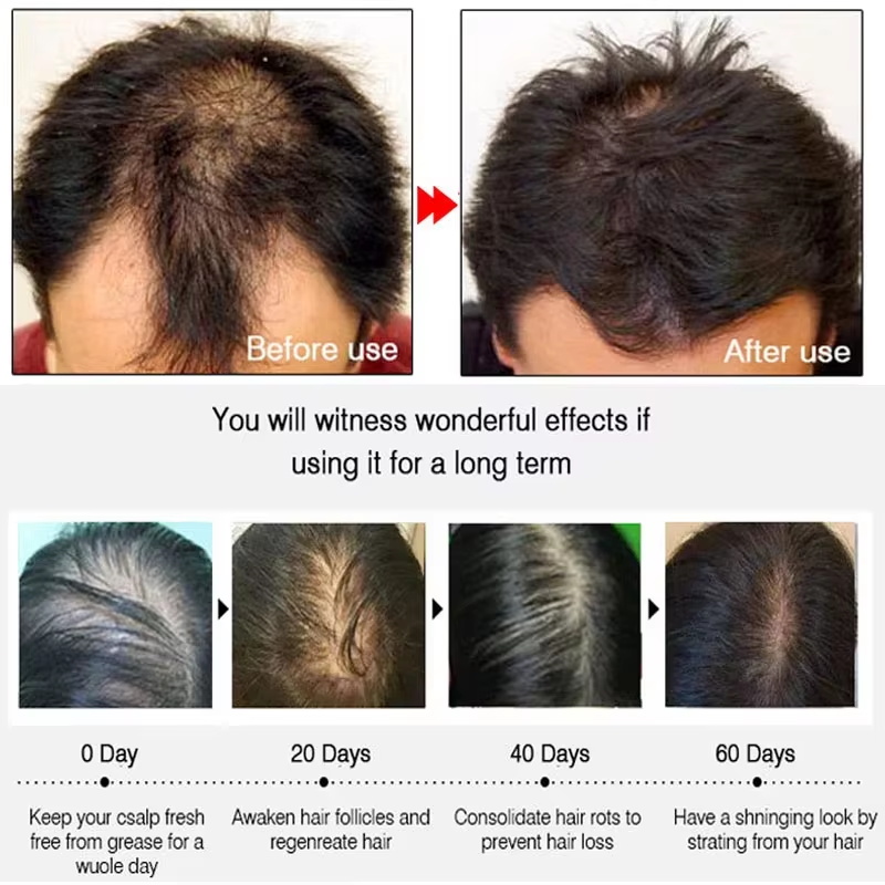 Schnelles Ingwer-Haarwuchsspra – Hair Care Frizzy Hair Bewertung und Preis